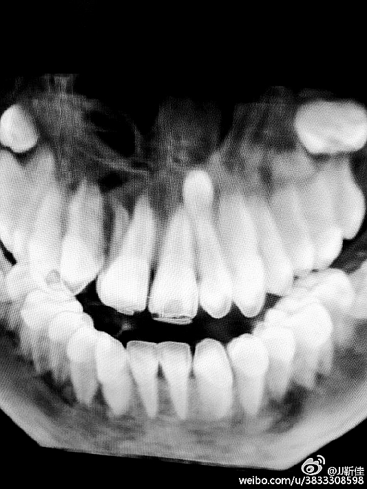 e47ba5b6jw1f6hrgoosufj20ku0rsgru.jpg e47ba5b6jw1f6hrgoosufj20ku0rsgru.jpg