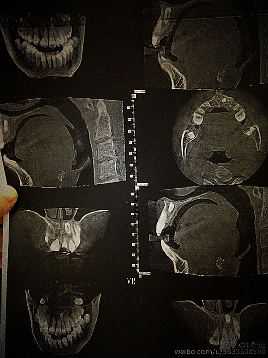 e47ba5b6jw1f6hswncqvaj20ku0rs0yu.jpg e47ba5b6jw1f6hswncqvaj20ku0rs0yu.jpg