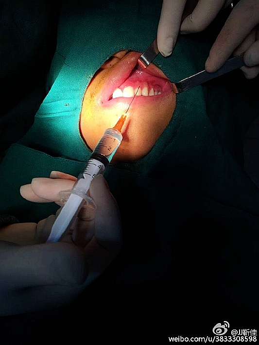 e47ba5b6jw1f6hsy6semdj20ku0rsgoy.jpg e47ba5b6jw1f6hsy6semdj20ku0rsgoy.jpg