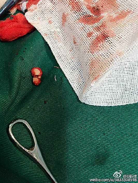 e47ba5b6jw1f6hsyxdwhlj20ku0rs7c8.jpg e47ba5b6jw1f6hsyxdwhlj20ku0rs7c8.jpg