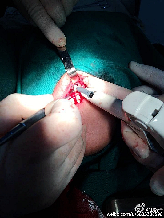 e47ba5b6jw1f6hsztmccwj20ku0rsado.jpg e47ba5b6jw1f6hsztmccwj20ku0rsado.jpg