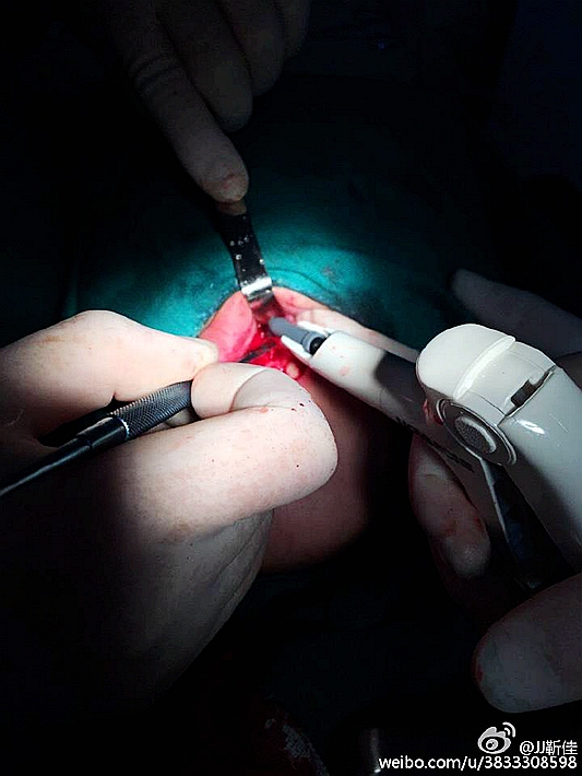 e47ba5b6jw1f6hsztzt6jj20ku0rsq5w.jpg e47ba5b6jw1f6hsztzt6jj20ku0rsq5w.jpg