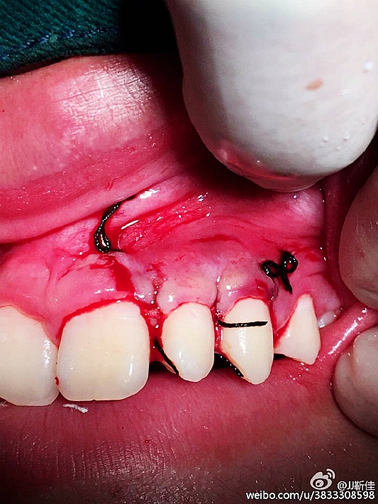 e47ba5b6jw1f6ht0yzoimj20ku0rstdd.jpg e47ba5b6jw1f6ht0yzoimj20ku0rstdd.jpg