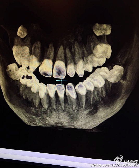 e47ba5b6jw1f6ht17taudj20ku0rsdjr.jpg e47ba5b6jw1f6ht17taudj20ku0rsdjr.jpg