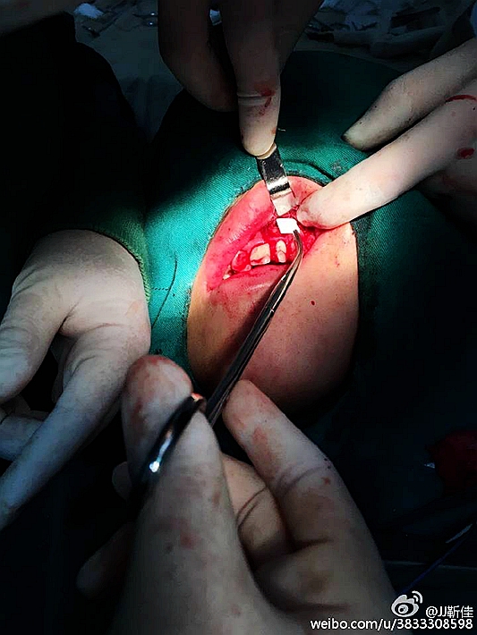 e47ba5b6jw1f6ht0872axj20ku0rsdj9.jpg e47ba5b6jw1f6ht0872axj20ku0rsdj9.jpg