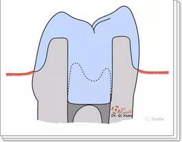 360截圖20170422115042957.jpg 360截圖20170422115042957.jpg