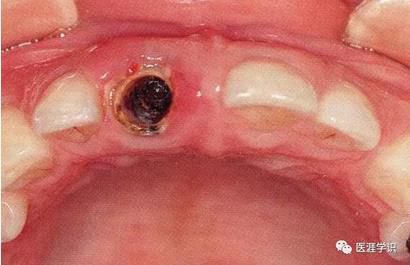 360截圖20170422121027781.jpg 360截圖20170422121027781.jpg