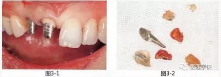 360截圖20170422121128058.jpg 360截圖20170422121128058.jpg