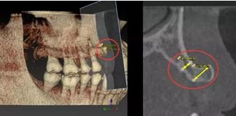 360截圖20170422134425475.jpg 360截圖20170422134425475.jpg