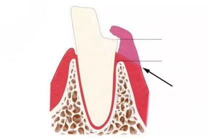 360截圖20170422145911166.jpg 360截圖20170422145911166.jpg