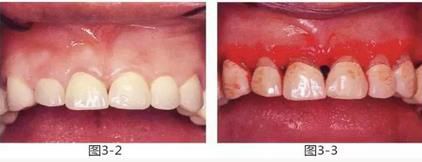 360截圖20170422145921875.jpg 360截圖20170422145921875.jpg