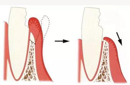360截圖20170422145928622.jpg 360截圖20170422145928622.jpg