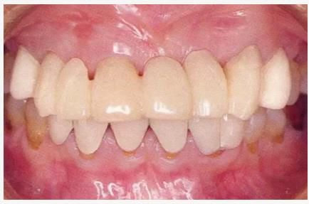 360截圖20170422150047289.jpg 360截圖20170422150047289.jpg