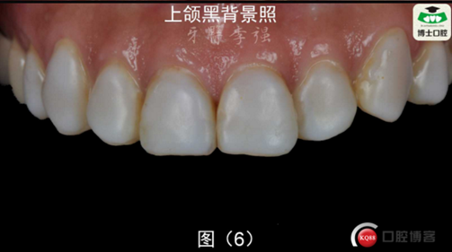 5REQ7}U64B%O91%4ZU_{{5T.png 5REQ7}U64B%O91%4ZU_{{5T.png