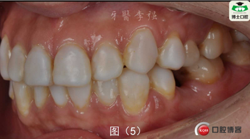 KLV`@J08ZVQ65UZ(`R[(G`A.png KLV`@J08ZVQ65UZ(`R[(G`A.png