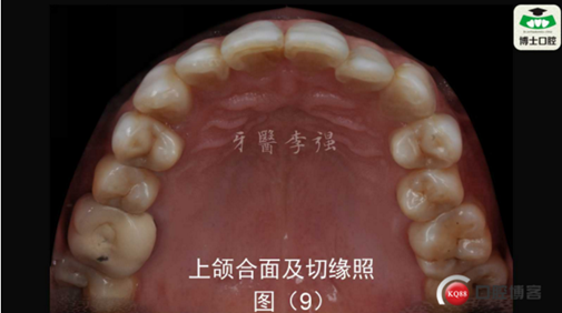 Q[@0XS{}`YBJEWGIYSO$PW9.png Q[@0XS{}`YBJEWGIYSO$PW9.png