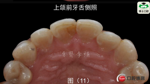 RW%RPQ2OY5$B[CQLYM4OBA7.png RW%RPQ2OY5$B[CQLYM4OBA7.png