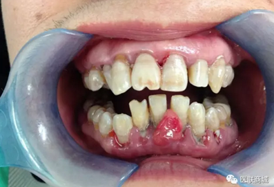 VNY3MFIRSH9{2EC$2O(U9RU.png VNY3MFIRSH9{2EC$2O(U9RU.png