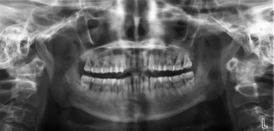 %9CMJ_CNB74A%}M`00K`U[X.png %9CMJ_CNB74A%}M`00K`U[X.png