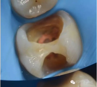 %30SPK[BJ6O7%77YTIB3SI0.png %30SPK[BJ6O7%77YTIB3SI0.png