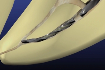 PB0G)QB1@0M7224_HYY$I~M.png PB0G)QB1@0M7224_HYY$I~M.png