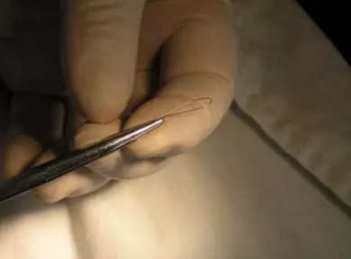 弓絲結(jié)扎及扎絲末端處理技巧 弓絲結(jié)扎及扎絲末端處理技巧