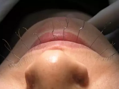 弓絲結(jié)扎及扎絲末端處理技巧 弓絲結(jié)扎及扎絲末端處理技巧