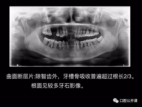 10.webp.jpg 10.webp.jpg