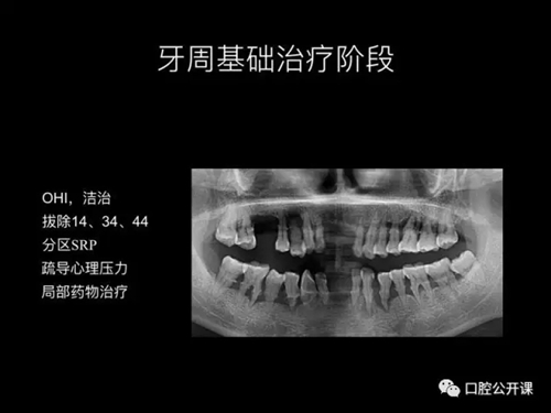 12.webp.jpg 12.webp.jpg