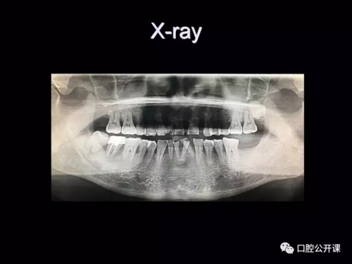 25.webp.jpg 25.webp.jpg