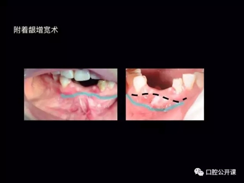 28.webp.jpg 28.webp.jpg