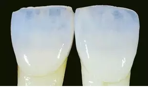 賀利氏 Opal 歐鉑樹脂 賀利氏 Opal 歐鉑樹脂