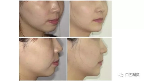 20.webp.jpg 20.webp.jpg