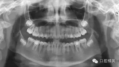 1.webp.jpg 1.webp.jpg