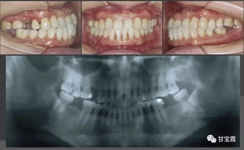 1.webp.jpg 1.webp.jpg