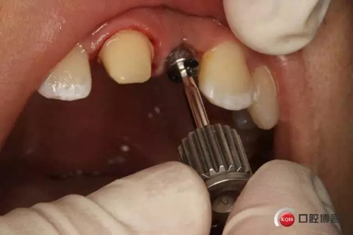 5.webp.jpg 5.webp.jpg