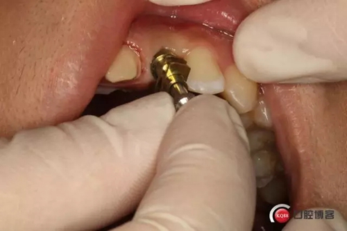 6.webp.jpg 6.webp.jpg