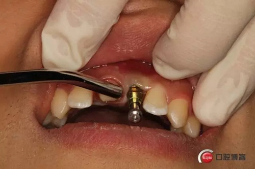 8.webp.jpg 8.webp.jpg