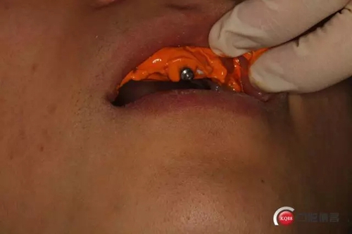 11.webp.jpg 11.webp.jpg