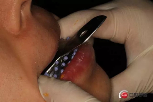 15.webp.jpg 15.webp.jpg