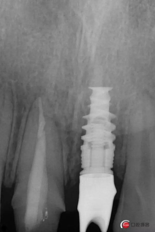 17.webp.jpg 17.webp.jpg