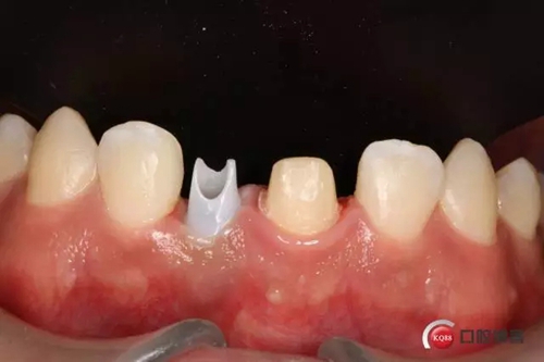 18.webp.jpg 18.webp.jpg