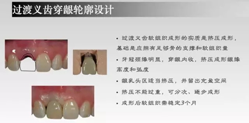 3.webp.jpg 3.webp.jpg