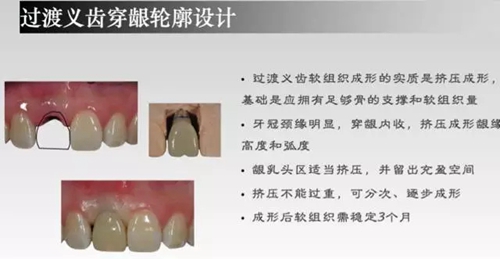 4.webp.jpg 4.webp.jpg