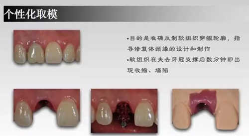 5.webp.jpg 5.webp.jpg