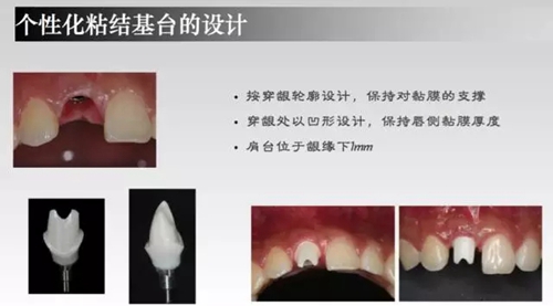 7.webp.jpg 7.webp.jpg