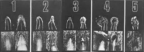 2.webp.jpg 2.webp.jpg