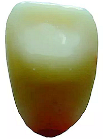 舌側(cè)無釉質(zhì)層.png 舌側(cè)無釉質(zhì)層.png