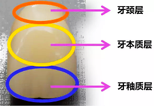 四層色樹脂牙.png 四層色樹脂牙.png