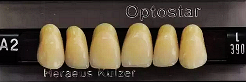 OptoStar歐星高端四層色牙1.png OptoStar歐星高端四層色牙1.png